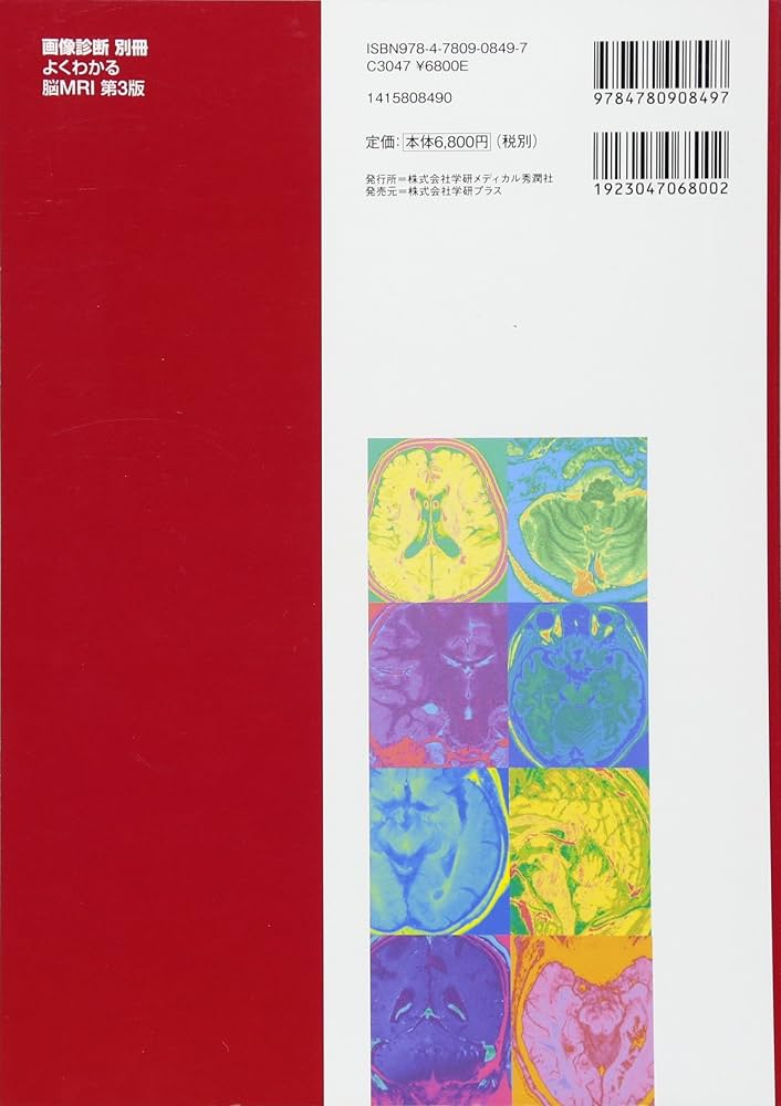よくわかる脳MRI 第3版 (画像診断別冊KEYBOOK) | 青木茂樹, 相田典子